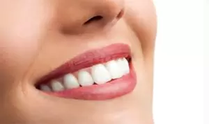 1, 2 ou 3 séances d'éclaircissement dentaire avec Reines De Beauté (jusqu'à 53% de remise)