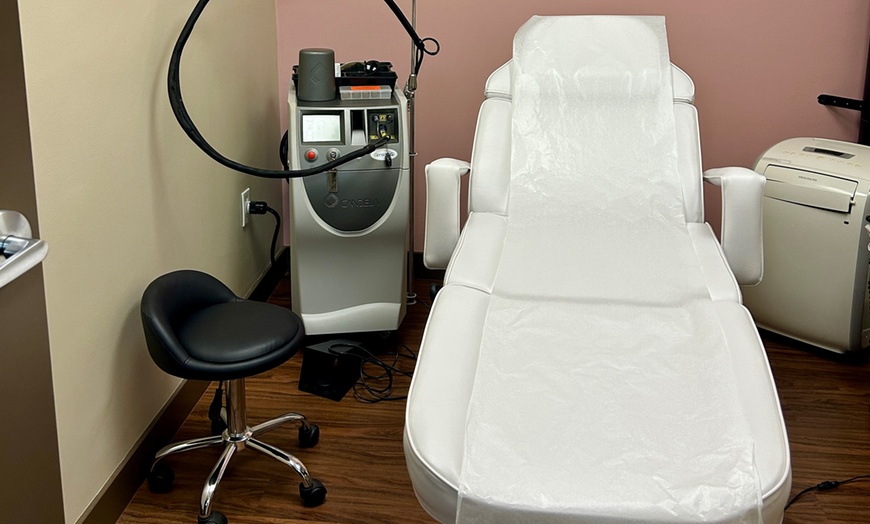 Image 2: Four Laser Hair Removal Sessions Small Area - 10, 20 or 15-Mins Each