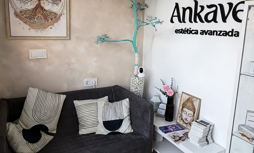 Image 6: Depilación con láser de diodo en zona a elegir para 1 persona