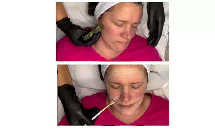 Get Radiant Skin:1, 3, or 5 Sessions(60 Mins) Choice of Silk Facial