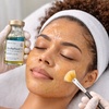 Image 1: Get Glowing Skin with Our Biorepeel Facial Packages