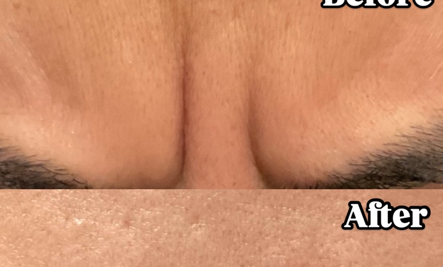 Image 2: Transform with 20, 40, or 60-Units of Jeuveau 