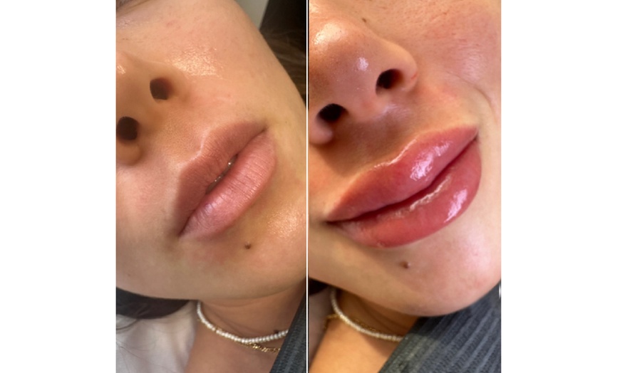 Image 5: Lip Blush Semi-Permanent Cosmetic Tattoo Treatment at TEAMO&T