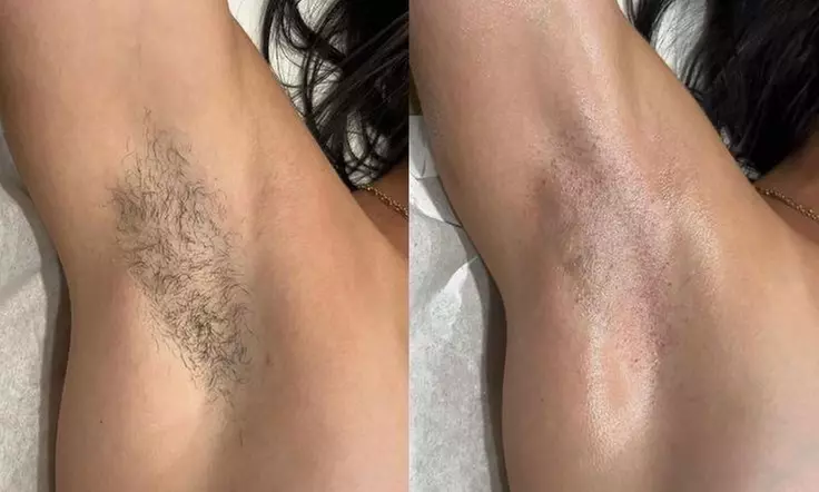 Women Brazilian Wax / Brazilian + Underarm / All-Gender Full Back Wax