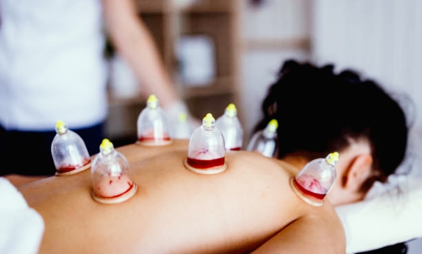 Image 2: Revitalize Your Body: One Cupping Session with Consultation