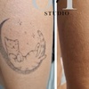 Image 8: Up to 86% Off on Tattoo Removal at Sure Thing Studio