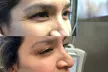 Experience Rejuvenation At Sona MedSpa's 20 Units of Botox Treatment (Up to 30% Off) - Smooth & Youthful Skin - Second Medium