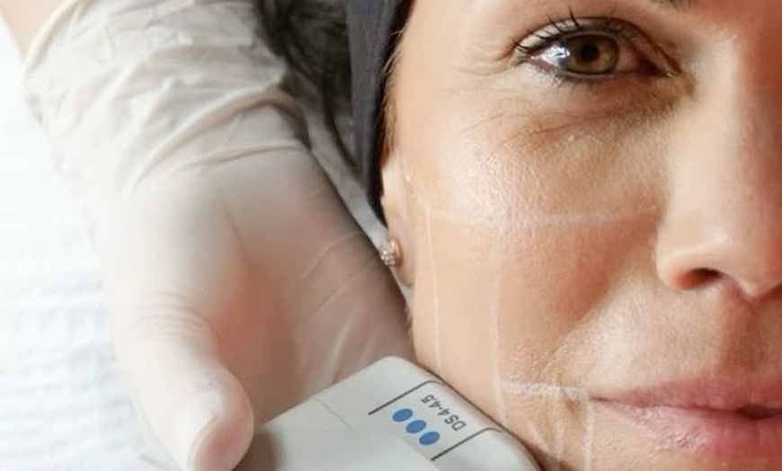 Image 1: Revitalize Your Summer Glow with Luxury Microdermabrasion Facial