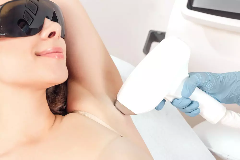 3 oder 5 Behandlungen: IPL-Haarentfernung für Damen und Herren