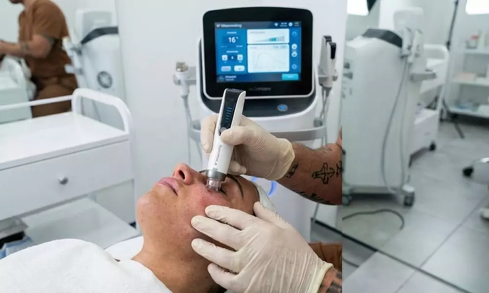 Fractional RF Microneedling Skin Rejuvenation Treatment