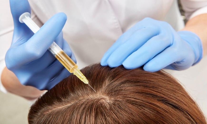 Image 4: Consultation for PRP Hair Restoration Available