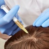 Image 4: Consultation for PRP Hair Restoration Available