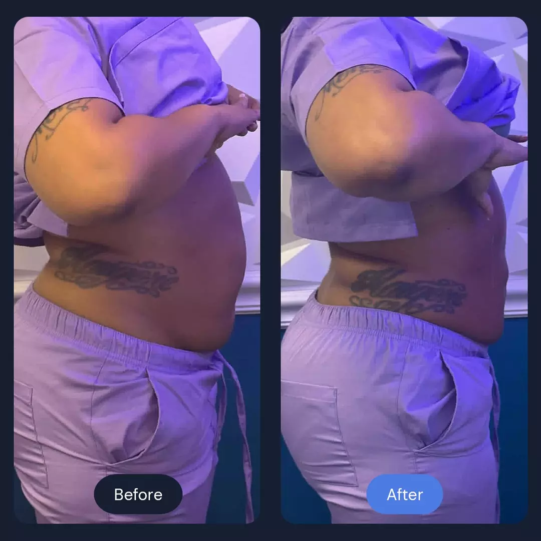 Intro Cryo Slimming or 4 or 6 Cryo Contour Sessions