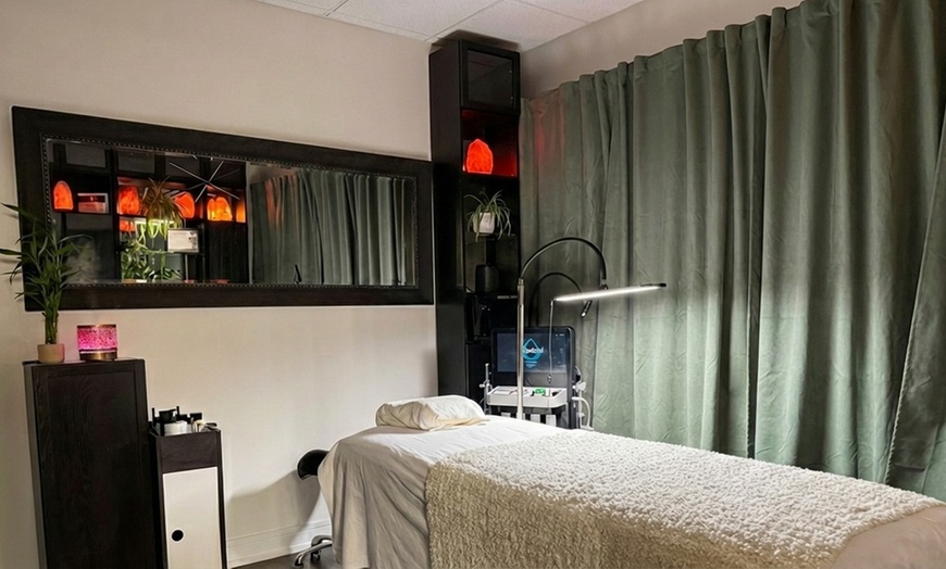 Image 3: Microneedling Treatment for Full Face or Neck & Decollete or a Package