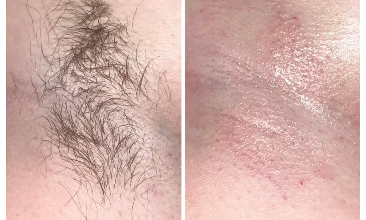 Eyebrow Waxing with Optional Brow Tint and Lip Wax or Underarm Wax