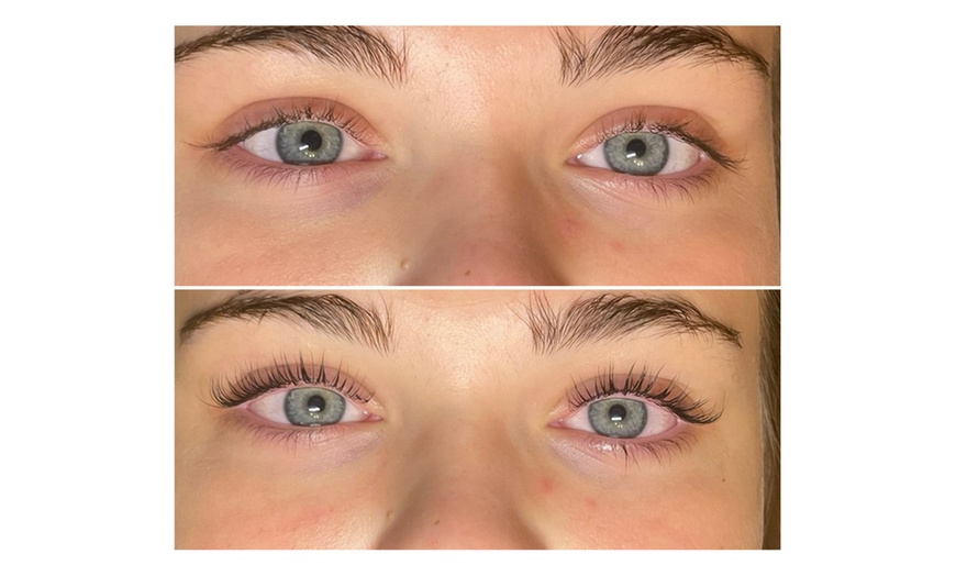 Image 2: Brow Lamination and Lash Treatments at Ageless MedSpa