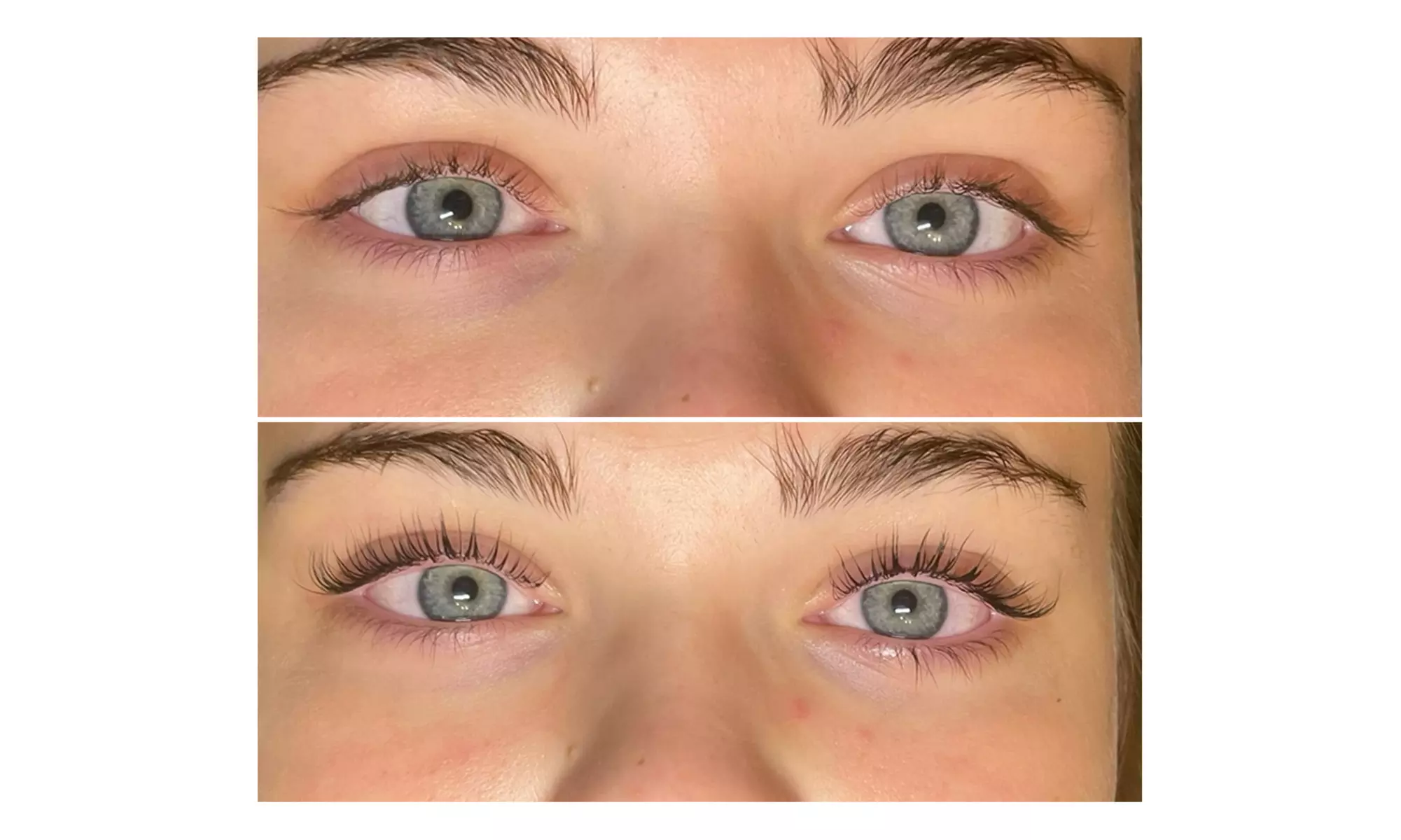 Brow Lamination and Lash Treatments at Ageless MedSpa