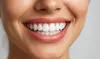 Achieve a Bright Smile with ZOOM In-Office Teeth Whitening at Avalon Dental - 62% Off