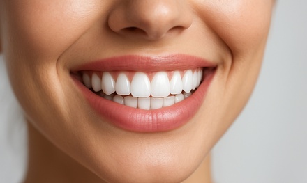 ZOOM In-Office Teeth Whitening - Avalon Dental