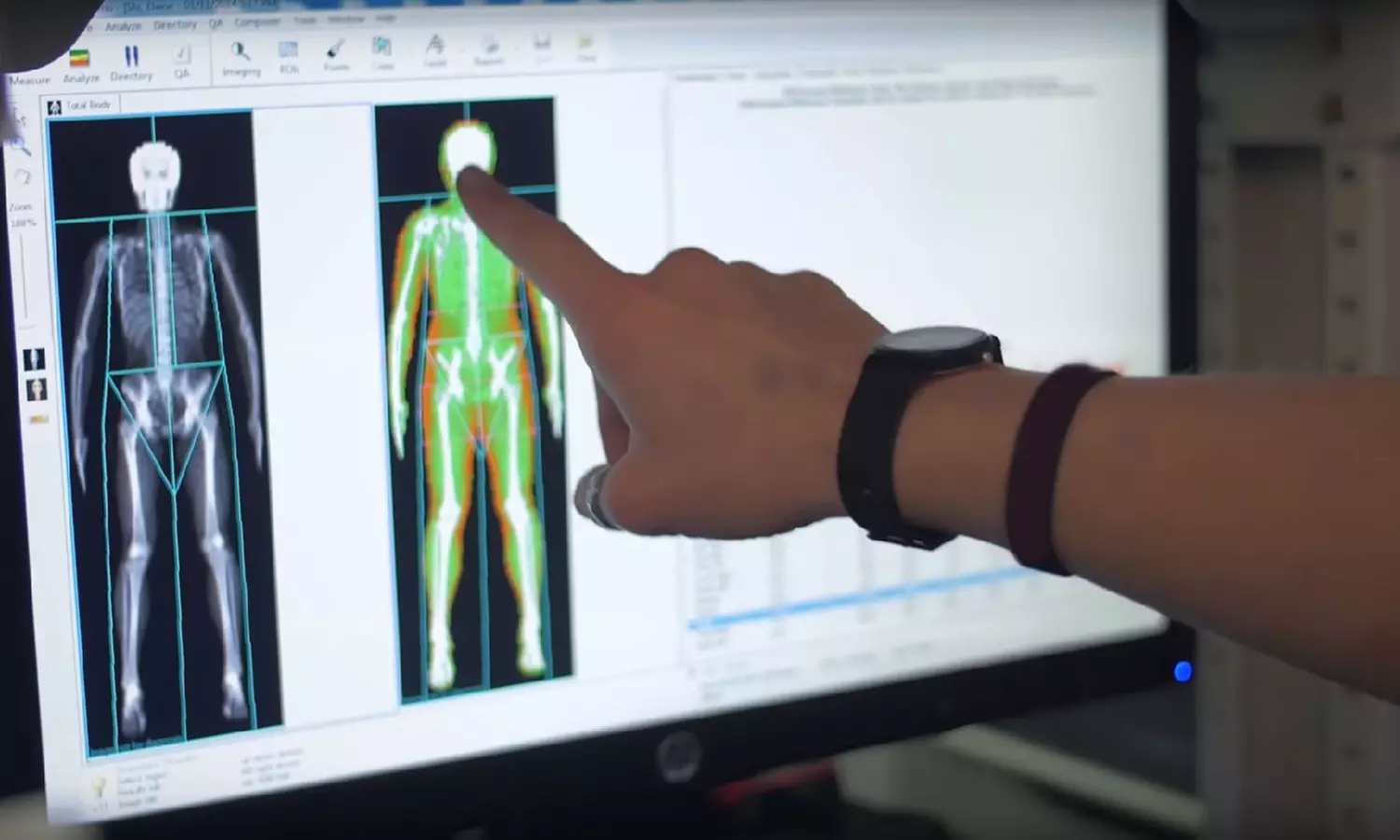 Ultimate Wellness Awaits: One “Dexa” DXA Body Composition Scan or One RMR Metabolic Health Test. 
41% Off) - Primary Image