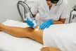 Up to 90% Off on Laser Hair Removal at Gentle Zap Laser Med Spa - Second Medium