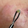 Image 5: 1, 2, or 3 Facials or Upgrade to Dermaplaning/Microdermabrasion