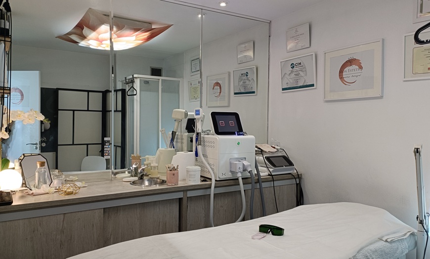 Image 4: 1 o 2 sesiones de eliminación de microblading