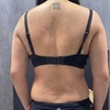 Image 2: Body Sculpting & Cellulite Reduction to Boost Contours & Confidence