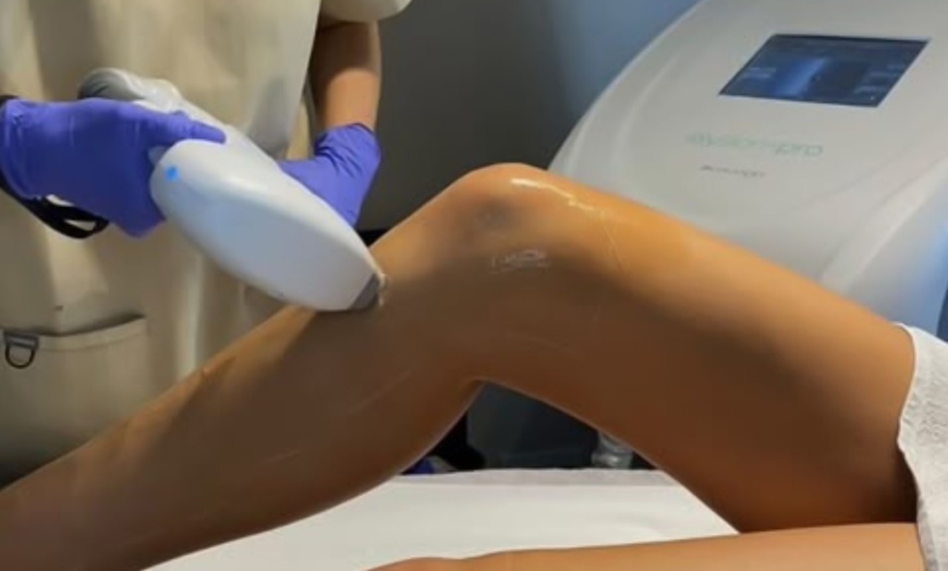 Image 9: Up to 88% Off on Laser Hair Removal at See You Laser