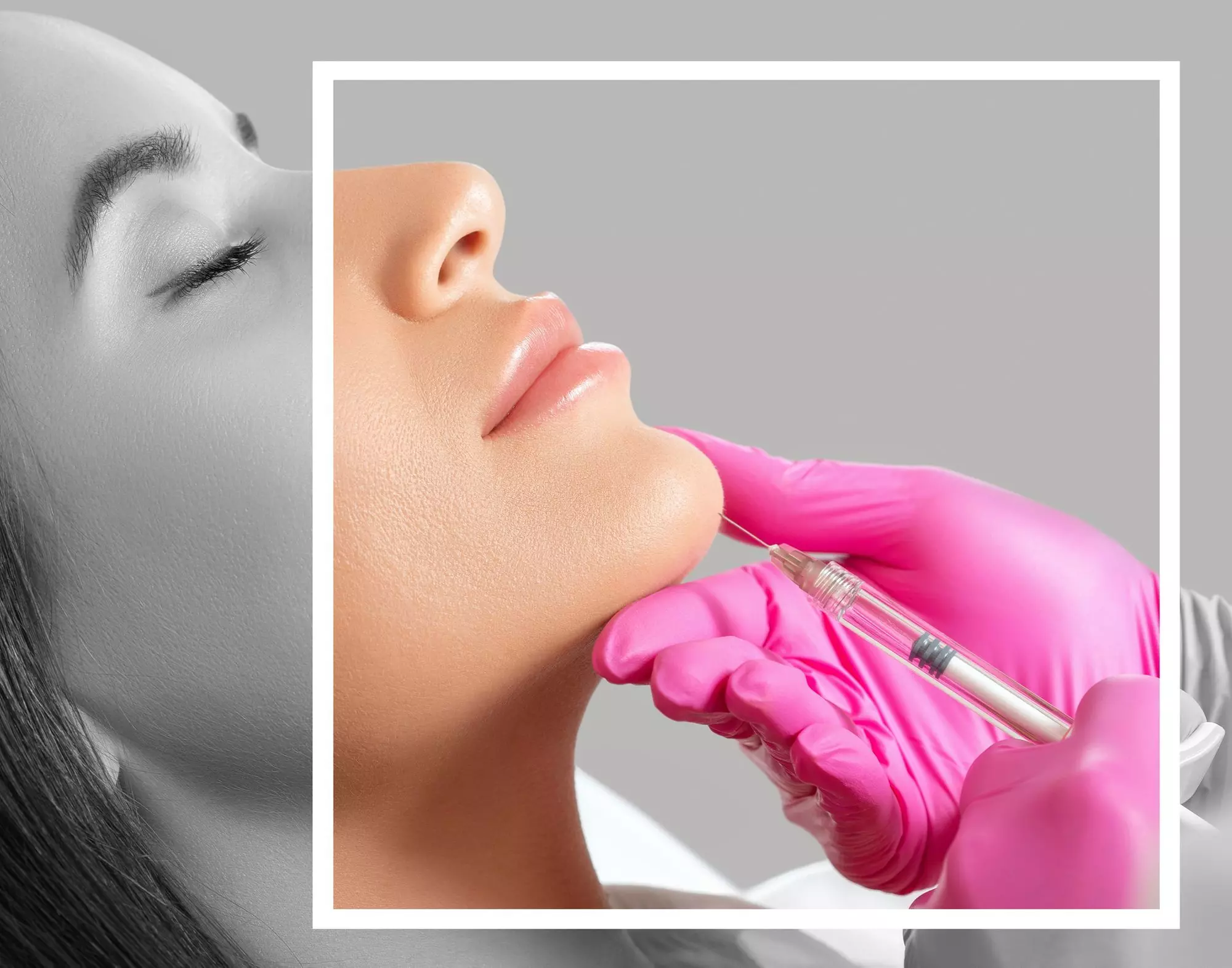 Up to 43% Off on Injection - Botox at Glam lab
