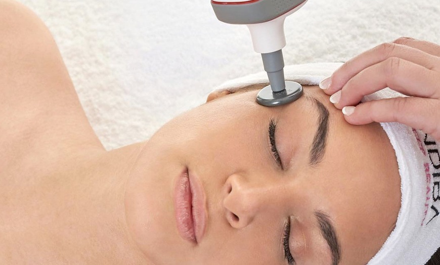 Image 6: 1 o 2 sesiones de radiofrecuencia Indiba facial reafirmante
