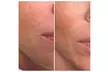 ✨ Glow from Within ✨

PRP Micro-Needling at Beauty Lash – Up to 62% Off Your Skin Revival! - Second Medium