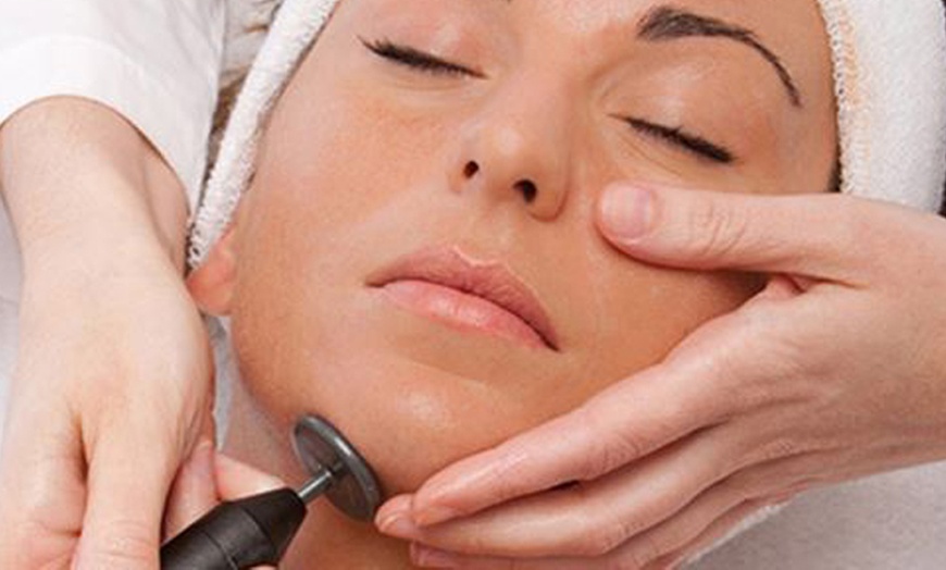 Image 1: 1 o 2 sesiones de radiofrecuencia corporal o facial 