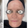 Image 3: 20 or 40 Units of Botox
