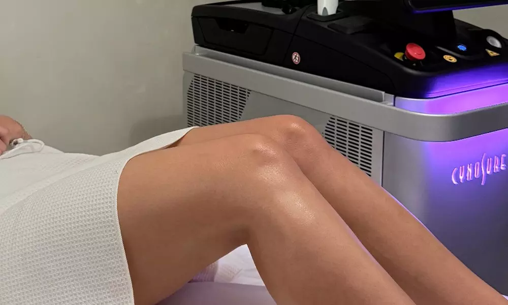 Get Smooth Skin with Laser Hair Removal Legs and Underarms Package at Amavi Wellness (Up to 57% Off) - Primary Image