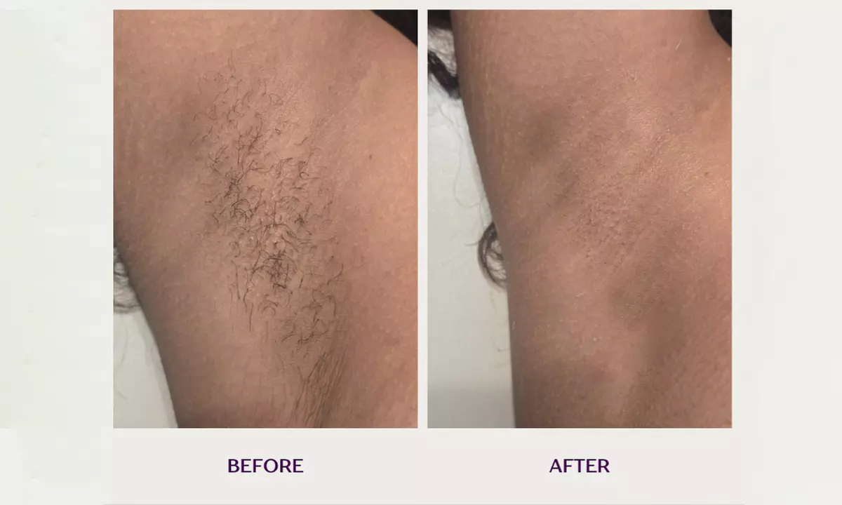 One Brow, Lip, Chin and Arm Wax, One Face, Arm or Half Legs Wax & More