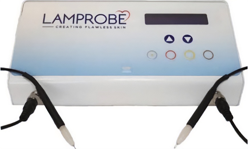 Image 5: One or Two Mole or Skin Tag Removal for Smooth Clear Skin