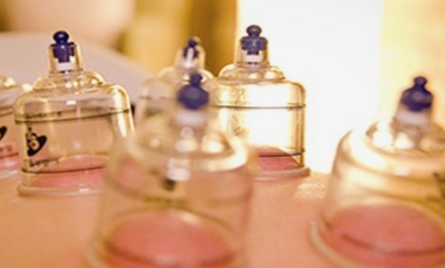 Image 1: Revitalize with Body cupping, Full Face/3 Session Cosmetic Acupuncture