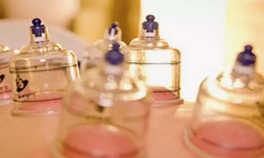 Achieve Wellness with Body cupping, Full Face Cosmetic /3 Session Package Acupuncture (Up to 33% Off)  - Primary Image