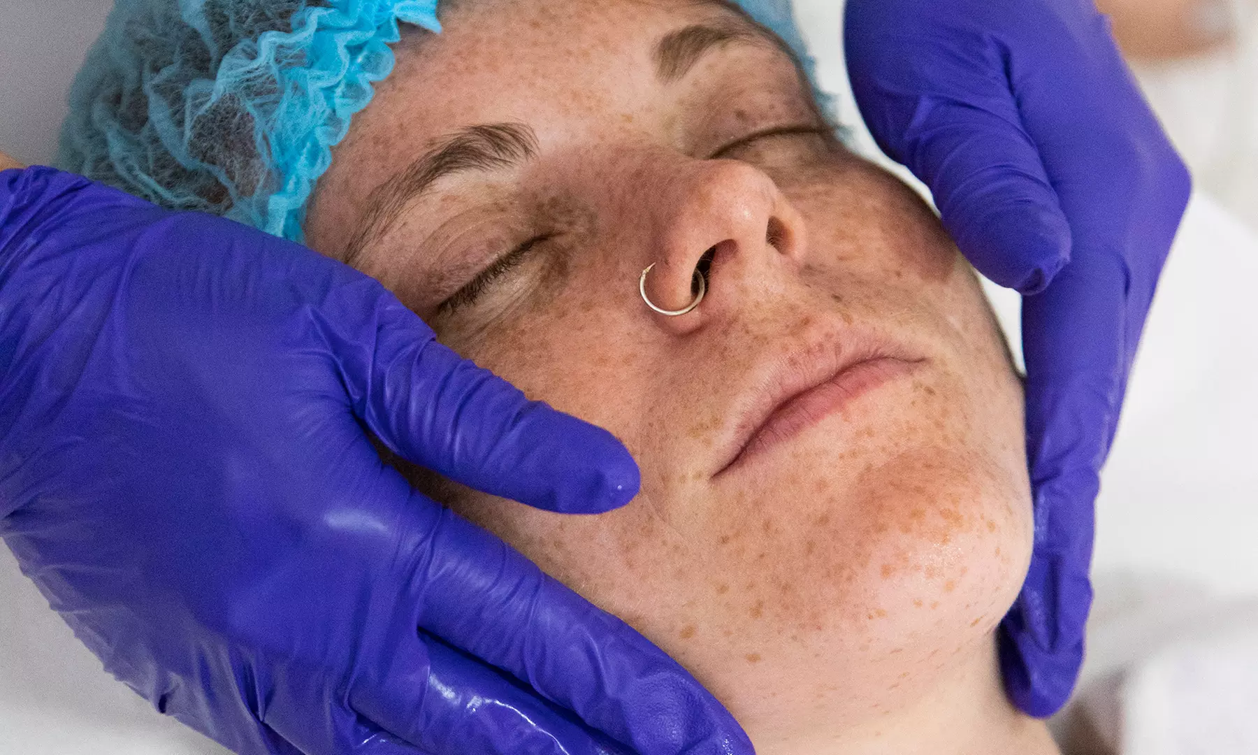 3 o 6 sesiones de tratamiento HIFU en The Look Madrid