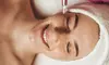 Transform Your Skin with One, Two, or Three PRP Microneedling at Valley Wellness & Aesthetics (Up to 66% Off)