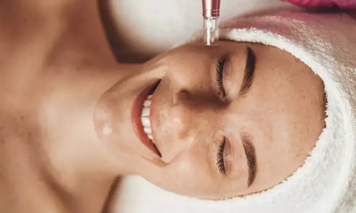 Transform Your Skin with One, Two, or Three PRP Microneedling at Valley Wellness & Aesthetics (Up to 66% Off) - Primary Image
