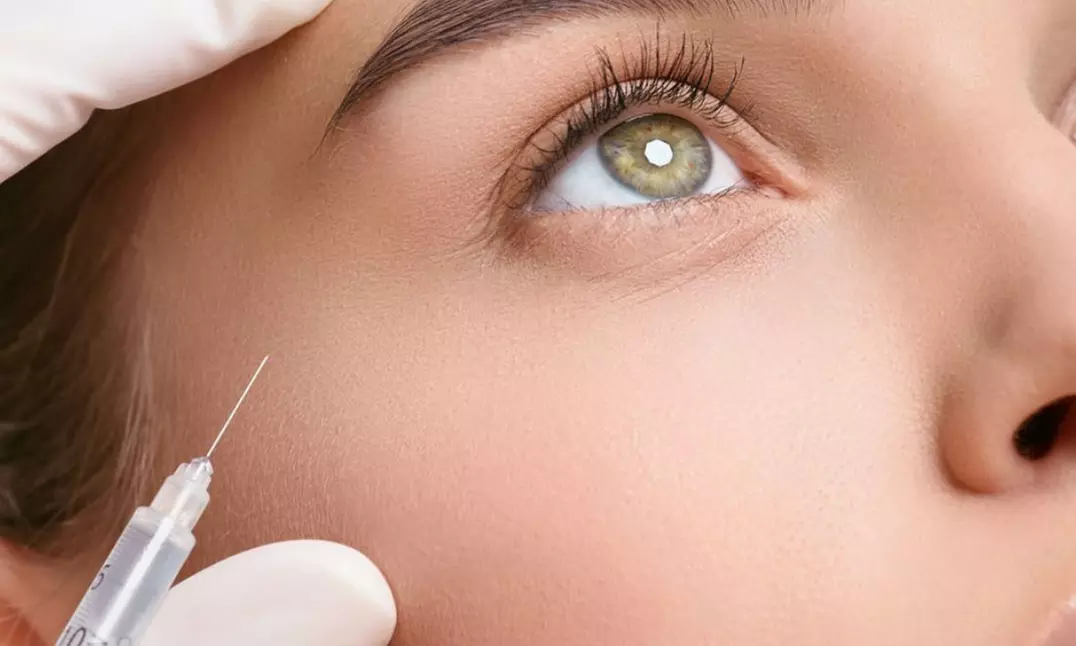 Up to 76% Off on Injection - Dermal Filler at Orchid Cosmetic - Primary Image