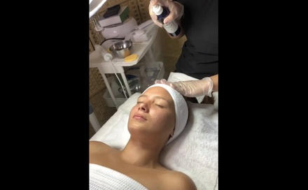 Hydrafacial with Extraction, LED Light Therapy, and Vitamin Infusion - Yolymbeautyspa