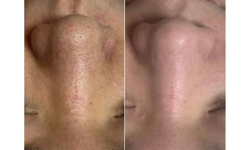 Image 5: 60-Min Facial, 90-Min Facial and Massage & 90-Min Anti-Aging Facial