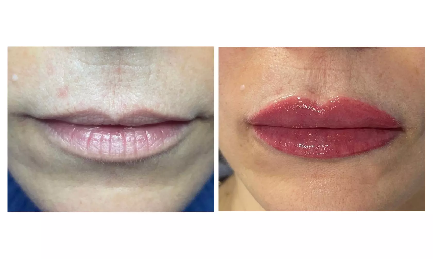 ¡Adiós, maquillaje! Sesión de micropigmentación de eyeliner o labios