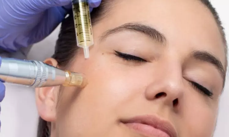 1 o 2 sesiones de fibroblast con plasma pen facial completo para 1
