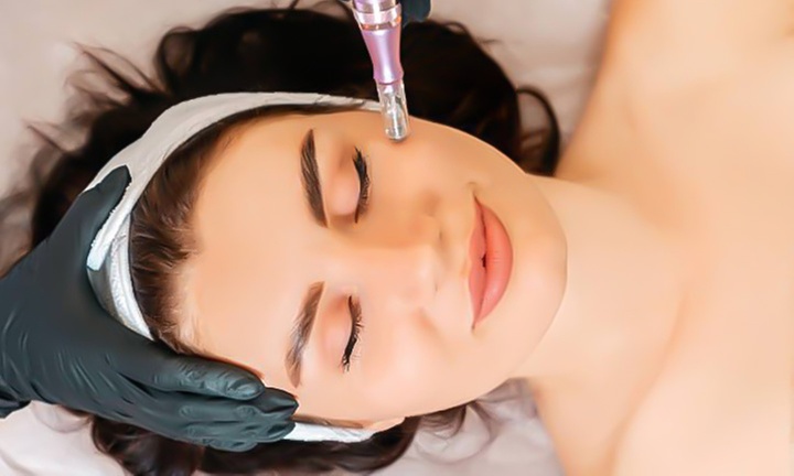 Transform Your Skin with One or Three Microneedling + PRP Sessions