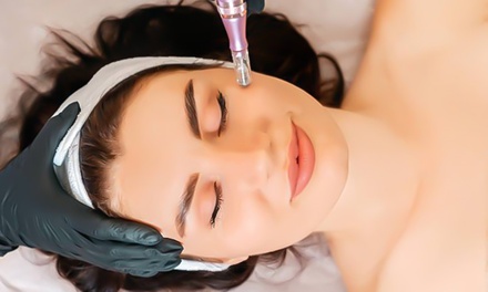 One Microneedling + PRP Session - Lily Aesthetics