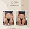 Image 2: Ultrasonic Cavitation Fat-Reduction Treatments for a Sleeker Look